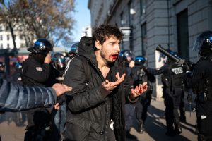 FRANCE – ARTHUR NACIRI POLICE ASSAULT DURING RETIREMENT REFORM DEMONSTRATION IN LYON