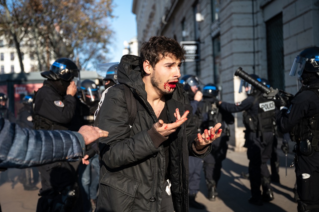 Violences policières : deux agents de la BAC de Lyon condamnés à 12 mois de prison avec sursis