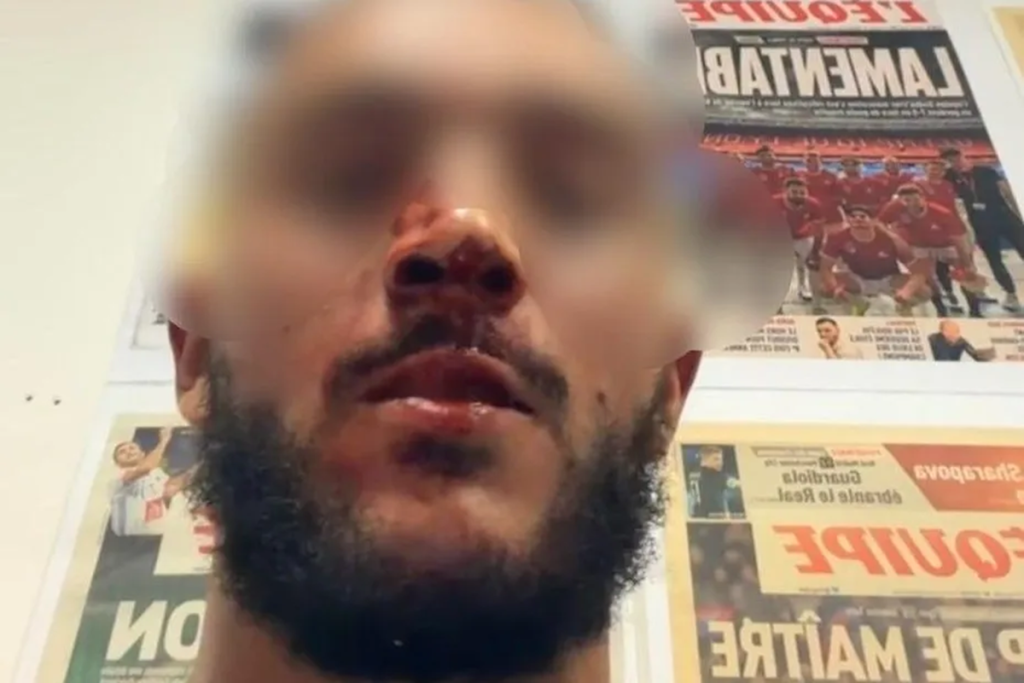 Trois agressions et des injures racistes en marge d’un match de l’Olympique lyonnais